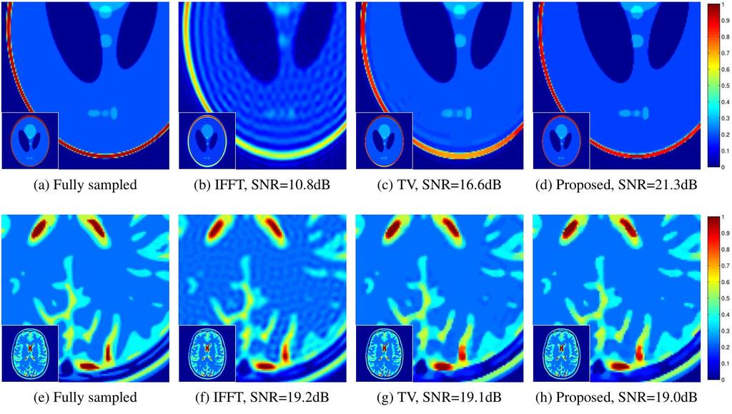 Super-resolution of MRI Medical Phantoms x8 x4