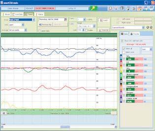Intuitive operation Will operate on Windows based operating systems SmartCEM Emissions Monitoring Software provides the complete solution to data gathering and analysis on -based monitoring systems.
