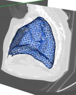 the fully reconstructed MVCBCT; (c) Triangulated lung mesh segmented from the FE phase of 4D planning CT; (d) The lung mesh transformed to the MVCBCT coordinate.