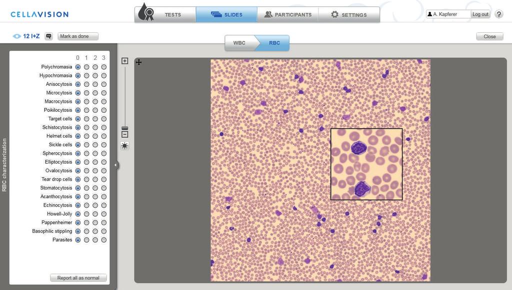 CellaVision Proficiency EXAMINER 2.3.4.5 Red Blood Cell Characterization 1. RBC tab 2. Zoom slider 3. Magnified area General Workflow 1. Click on the RBC (1) tab. 2. Zoom in to the RBC image using either the mouse wheel or the zoom slider (2).