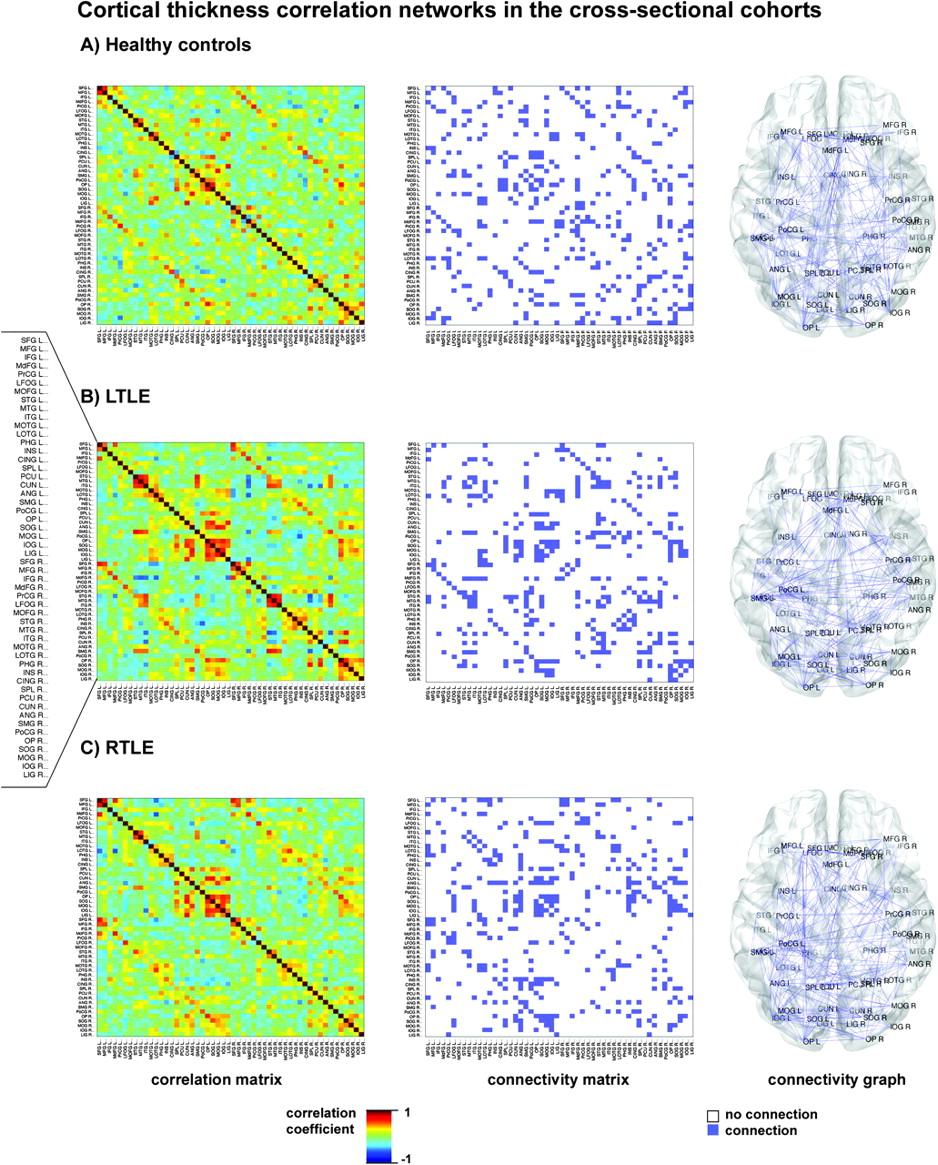Cortical thickness correlation networks
