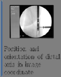 This subsystem acquires a few X-Ray images from the fluoroscope to recover an axis of