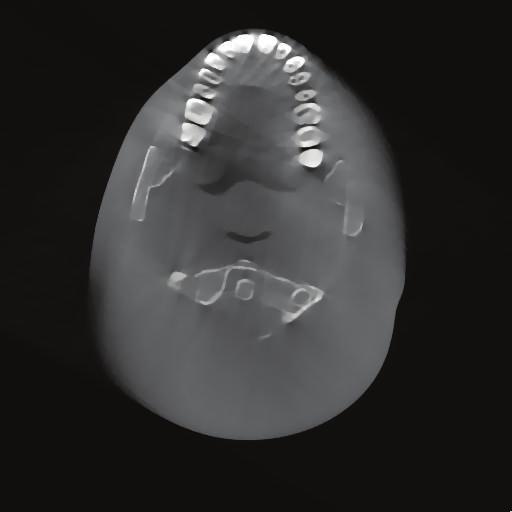 image. scan mode, it is another key research to reconstruct CBCT images accurately and fast using GPU acceleration.