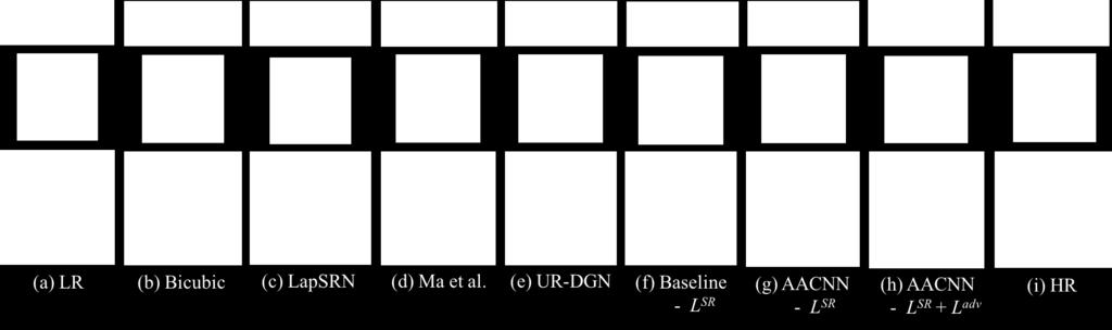 (c) LapSRN [6]. (d) Ma et al. [10]. (e) UR-DGN [16]. (f) Baseline - L SR. (g) AACNN - L SR. (h) AACNN-L SR +L adv. (i) High-resolution images.