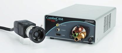 M ombom HD he JDMD ombom HD incorporates a high definition camera and high-intensity D light source into one complete system while maintaining a small footprint.