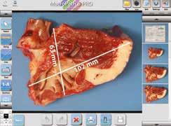FULL DOCUMENTATION MacroPATH pro-x State-of-the-art macro digital imaging The egross pro-x built-in MacroPATH pro-x digital imaging technology is the most advanced system for full documentation of