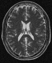 T1 MRI T2 MRI PD MRI 4 classes: CSF, Grey-matter, White-matter,