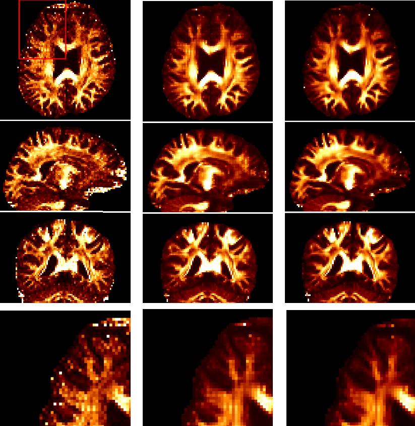 Figure 4. Fractional Anisotropy (FA) map computed on the DW-MRI dataset with high b-value.
