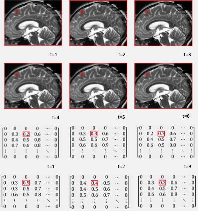 Figure 1: Brain Image Produced from MRI Scan 3 Data Manipulation Now researchers need to manipulate and analyze the data they have collected.