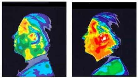 D. Gok et al. Fgure 1. Left panel: Thermographc mage of the head wth no expose to harmful cell phone radaton, Rght panel: Thermographc mage of the head after a 15-mnute phone call.