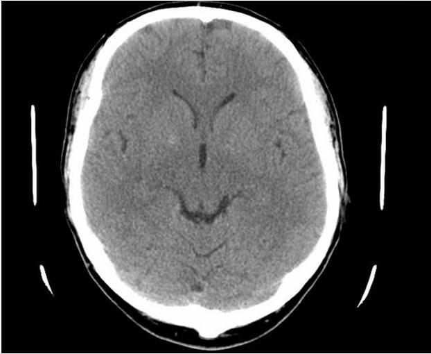D. Gok et al. Fgure. Sngle slce of the MRI scan of the human head and ts PBI representaton.
