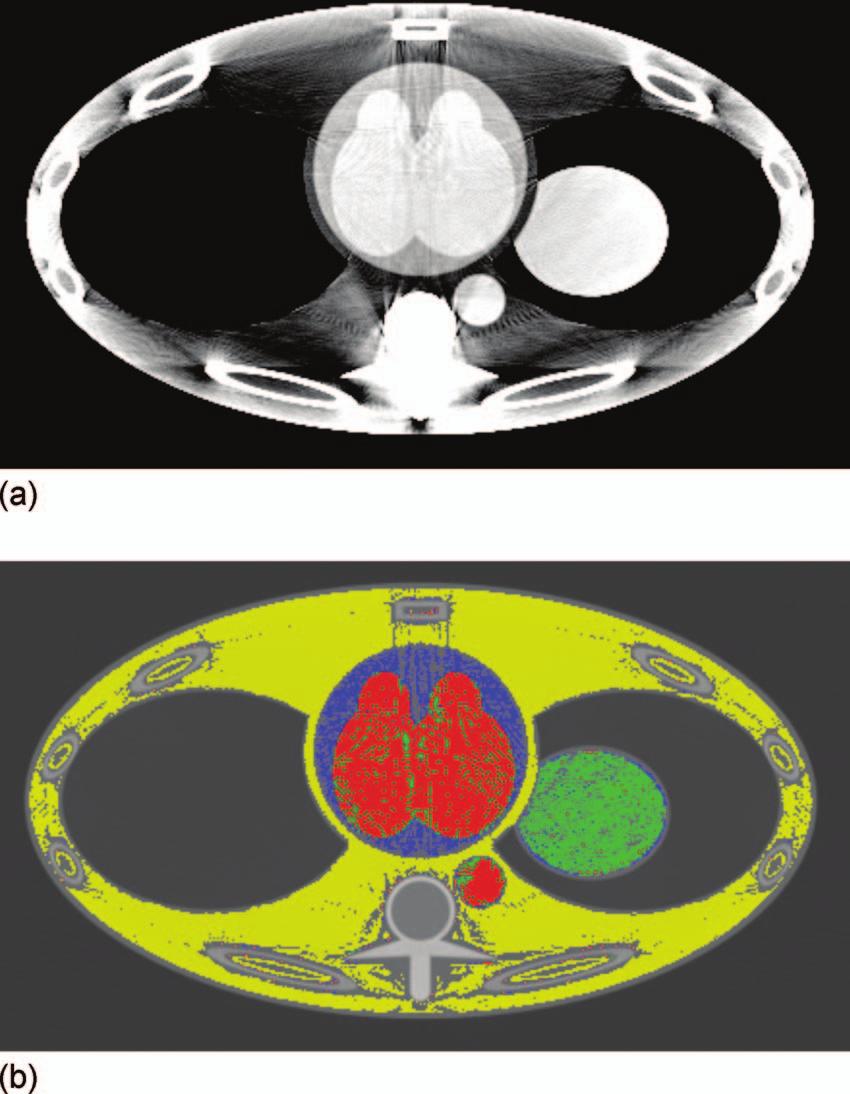 4482 B. Heismann and M. Balda: Quantitative image-based spectral reconstruction for computed tomography 4482 Blood density in the presence of iodine.1.9.
