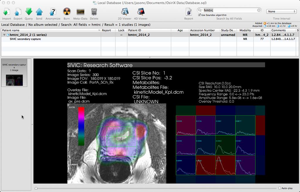 8. Save Scene as a DICOM Secondary Capture Image: Once you have a display set up that shows the