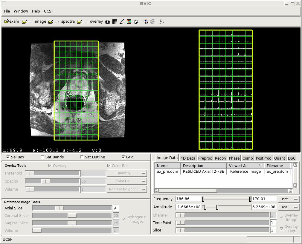 2. Load anatomical image: Click on the folder icon just left of the image label in the toolbar. Select Load Data from drop down menu. Navigate to sample MRI files (human/images).