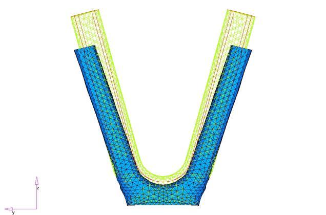 simulations. The shape of the stent produced by the optimization study is shown in Figures 12-13. Figure 12: Optimized Stent shown against Baseline (wireframe) Figure 13: Optimized Stent Weld Area 4.