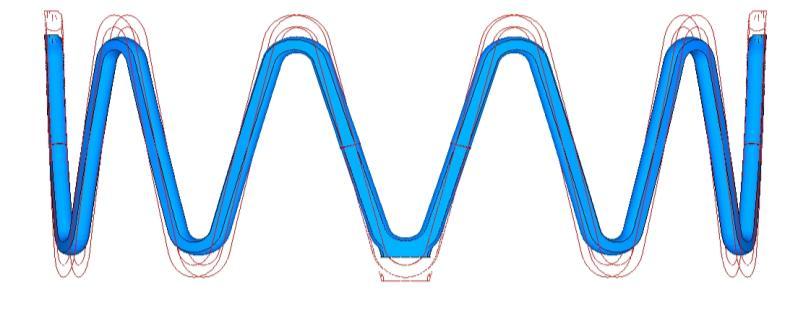 Figure 7: Upper Bound of Length Variable: Length Variable=1; Stent