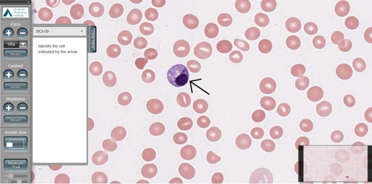API ImageViewer - The Basics When the ImageViewer opens, you will see the patient slide. The example below shows a peripheral blood smear. 1. The tool bar is located on the left side of the screen. 2.