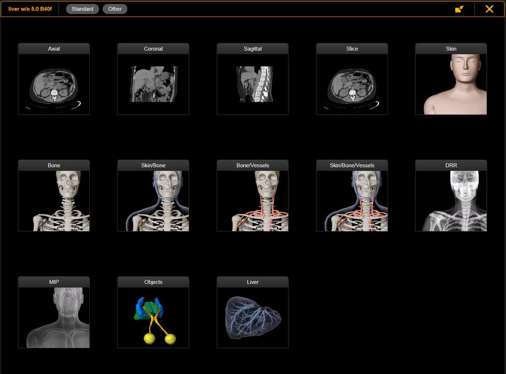 USING VIEWER 3 USING VIEWER 3.1 Reconstruction Views General Information Viewer allows you to view reconstructions in addition to the already selected images.