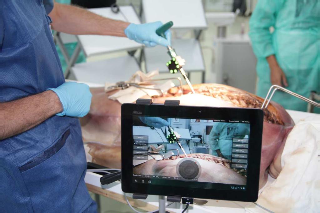 Augmented Reality and Navigation Tablet-based Image-guided Therapy Augmented Reality and