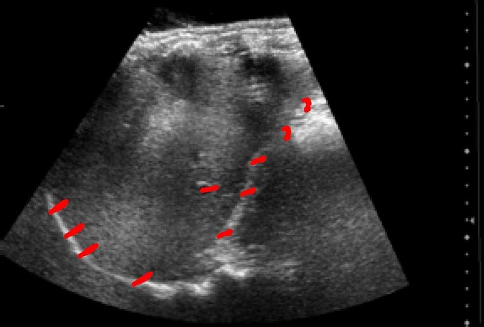 Ultrasound image of the