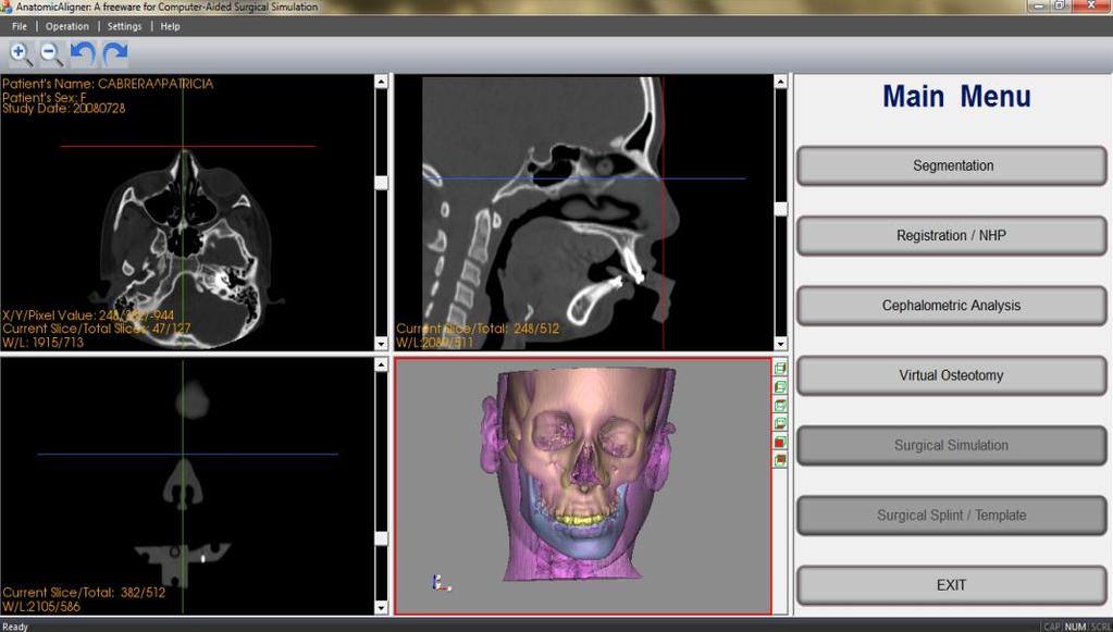 3. DESIGN, DEVELOPMENT AND IMPLEMENT OF CASS SYSTEM Once the data is collected, orthognathic surgery can be planned and simulated by six interface modules (Figure 6) in our CASS system.