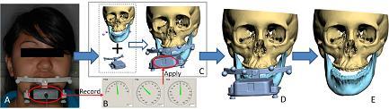yaw are applied to the gyroscope CAD model, reorienting the composite skull model to the NHP (Figure 19). Figure 19.
