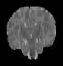 The neonatal brain atlas-template created from a single subject segmentation and blurring.