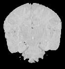 Standard automated segmentation methods fail as there is reduced contrast between white and gray matter in neonates.