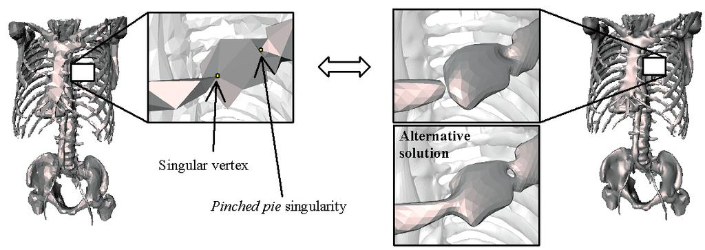 Fig. 12. Through our approach, a tetrahedral mesh resulting from a segmentation of a medical image (left) is converted to a combinatorial manifold.