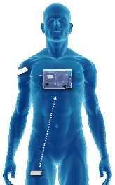 and in High-Value Healthcare Apps Sensing Body motion Pressure Acoustic