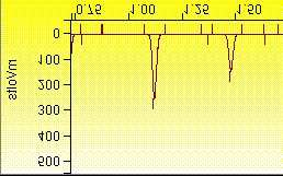drag in the chromatogram display to
