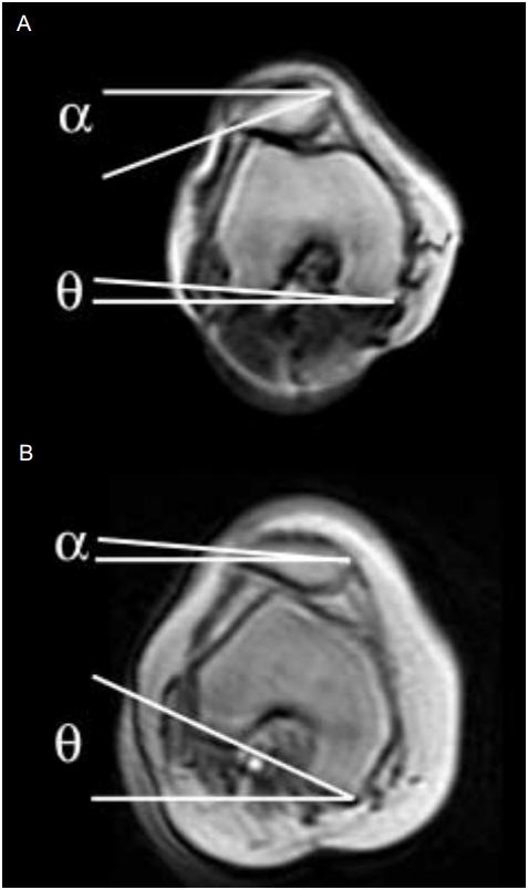 Context Knee-joint kinematics change under strain In particular: different flexion angles Weight-bearing imaging may be advantageous Enable weight-bearing acquisitions Dedicated CBCT