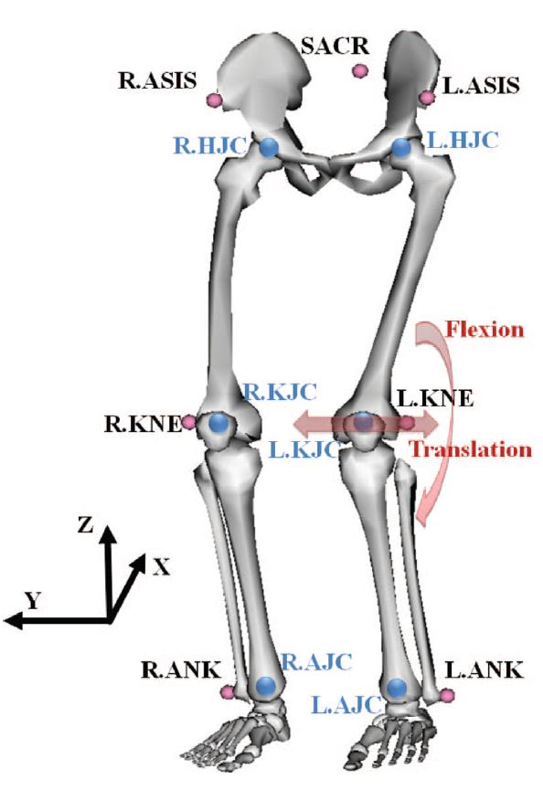 Context Weight-bearing acquisitions: From standing upright through to deep squats (65 flexion) Involuntary knee motion during scans Severe motion artifacts Previously: Use of fiducial