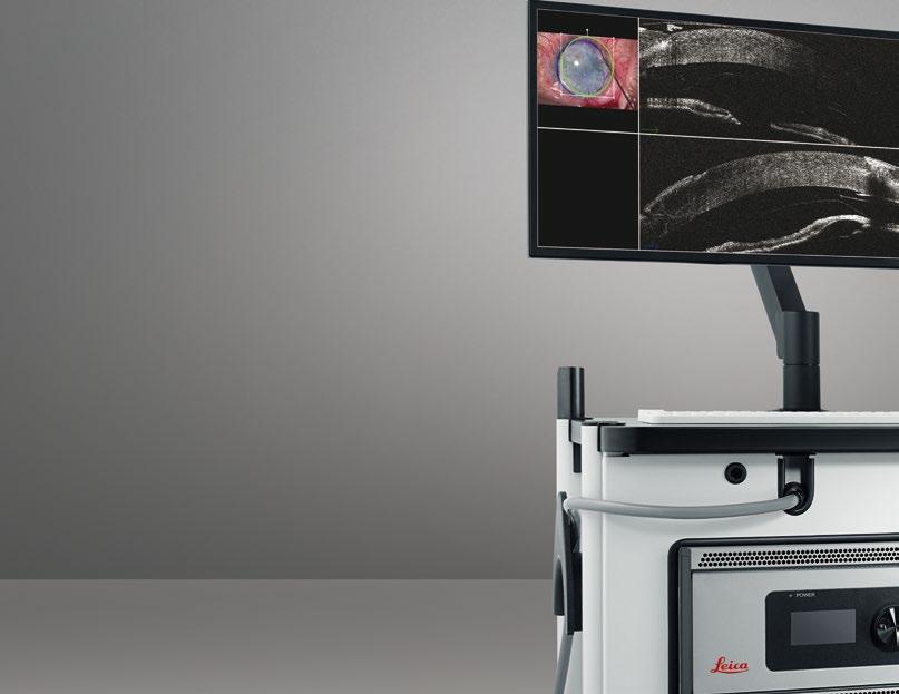 Large LCD for viewing of real-time OCT imaging, microscope image, and OCT scan position.