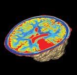 consuming. A typical neurological MR scan can take approximately 30-45 minutes per patient.