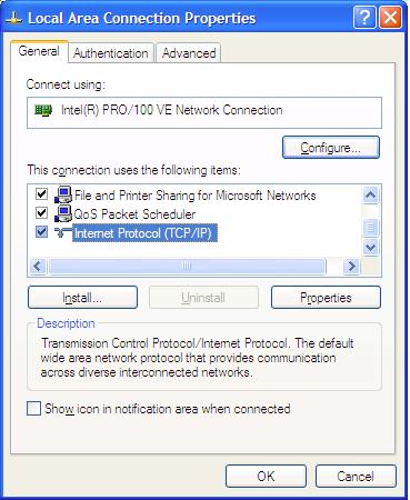 3. In the Local Area Connection Status dialog box, click the Properties button.