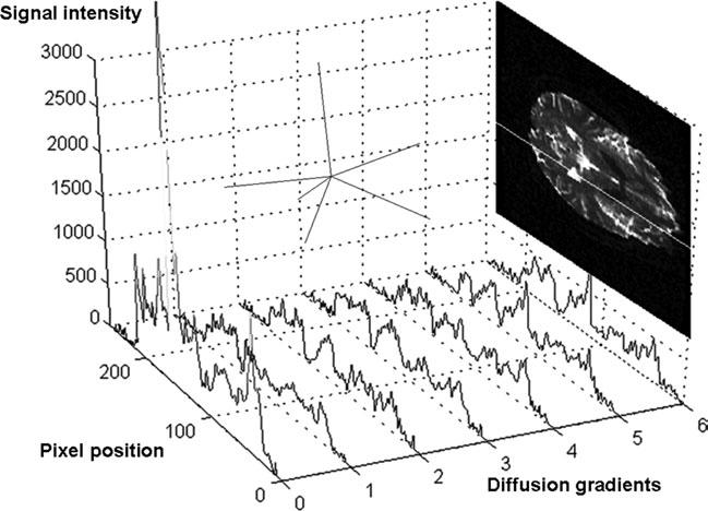 1462 Zhuang et al. Material Figure 1. DW image signal intensity changes with diffusion gradient directions (at b ¼ 3000 s/mm 2 ).