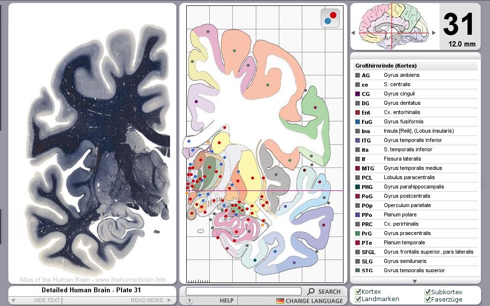 Aim Basics Transformation Specification The Atlas of the Human Brain