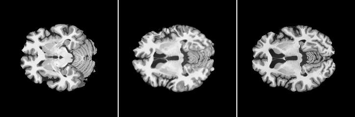 Multi-Atlas Brain MRI Segmentation with Multiway Cut 3 NiftyReg provides an efficient registration library.