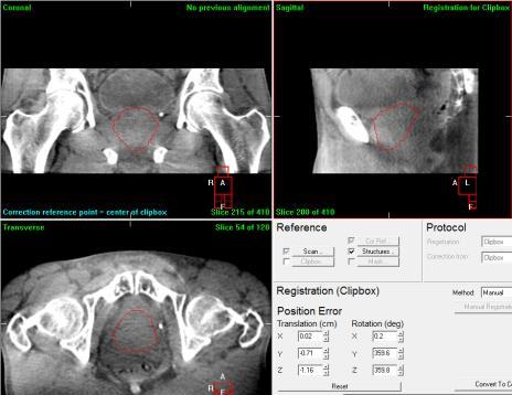 Bone Match Patient 3 Patient Setup Prostate Match (Mean of Experts) Patient 3 Patient Setup Absolute