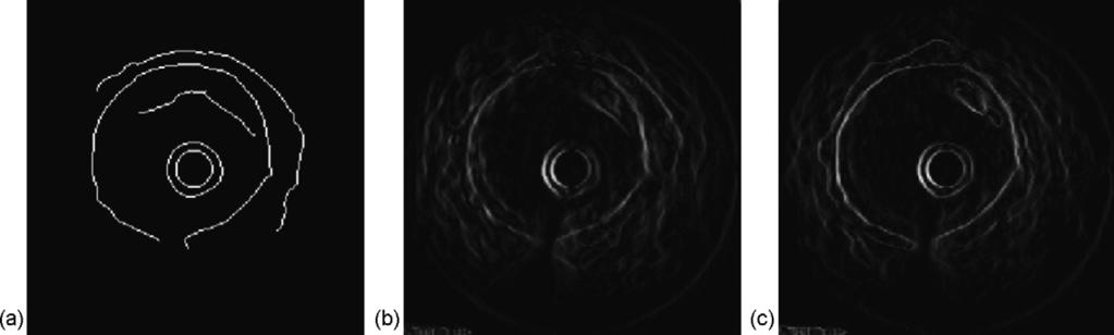 R. Sanz-Requena et al. / Computerized Medical Imaging and Graphics 31 (2007) 71 80 75 Fig. 6. (a) Canny binary edge map, (b) gray-scale edge map and (c) final edge map.