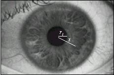 A Fast Circular Edge Detector for the Iris Region Segmentation 421 to detect the iris outer boundary. The start position r s is computed from Eq. (3).