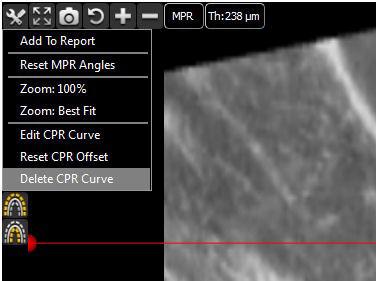 MPR Angles: allows to undo any inclination of the reference axis.