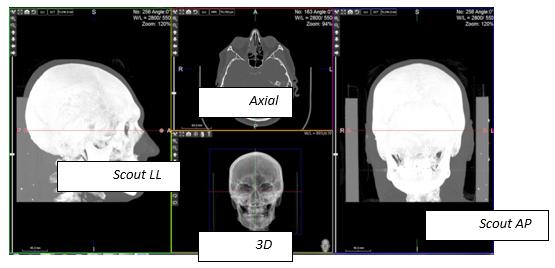 2.11.4 ORTHO/CEPH LAYOUT This layout is useful for cephalometric analysis.