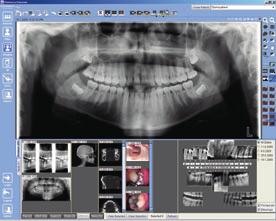 Maximum usability All imaging modalities can be viewed in the same easy-to-use user interface.