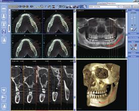 As the software is fully DICOM compatible, 3D studies can be transferred to any other system that receives studies in