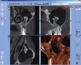 The 3D studies can also be written directly on a CD-ROM and forwarded to a consulting doctor.