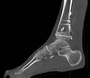 Figure 4. Sagittal plane through ankle. Reconstructions were generated from the data shown in Figure 3.