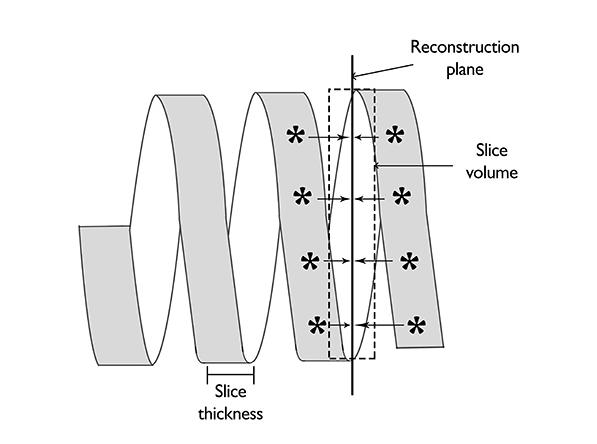 Figure 11. Data at similar locations along the helix are interpolated to form a 360 data set along the reconstruction plane, which is reconstructed to form an axial slice.