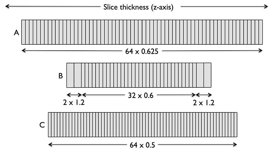 slices. A = GE Healthcare, B = Philips and Siemens, C = Toshiba. Figure 8.